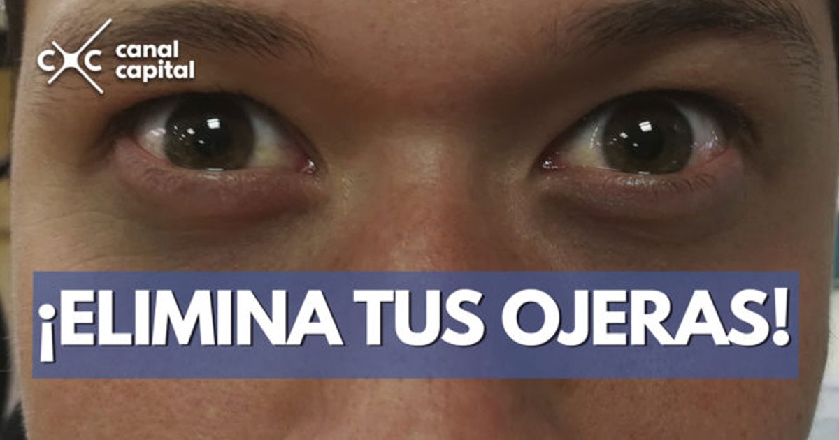 Beneficios del hielo para el cuidado de la piel